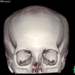 HUESO FINO 3D (Creator:CT1)